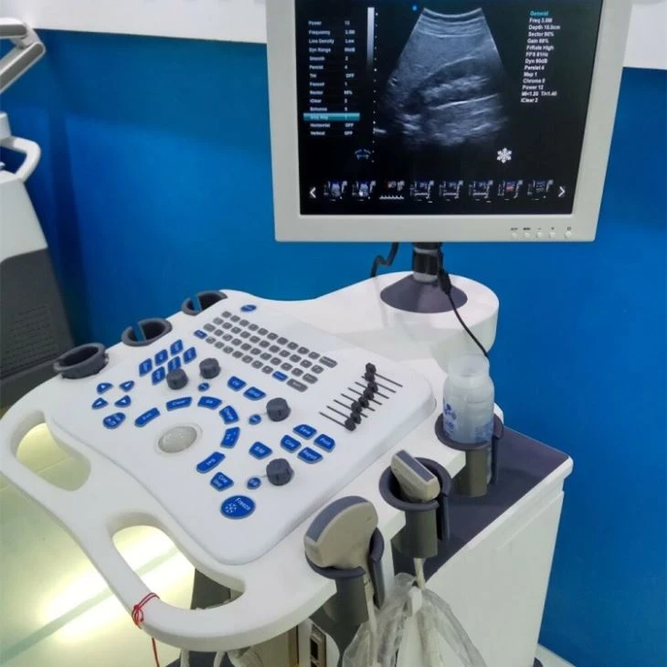 3D Color Digital Trolley Ultrasound Scanner 3D Color Digital Trolley Ultrasound Scanner